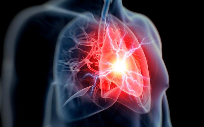 Saiba quais são as doenças cardiovasculares mais comuns